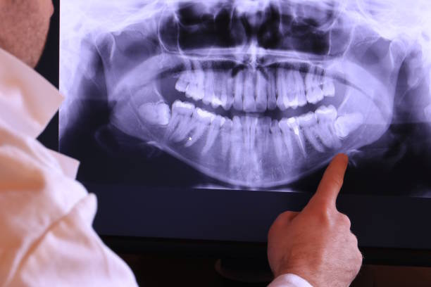 Best Emergency Root Canal Treatment in Iron Mountain, MI