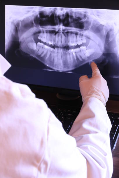 Best Emergency Dental Care for Abscessed Tooth in Iron Mountain, MI